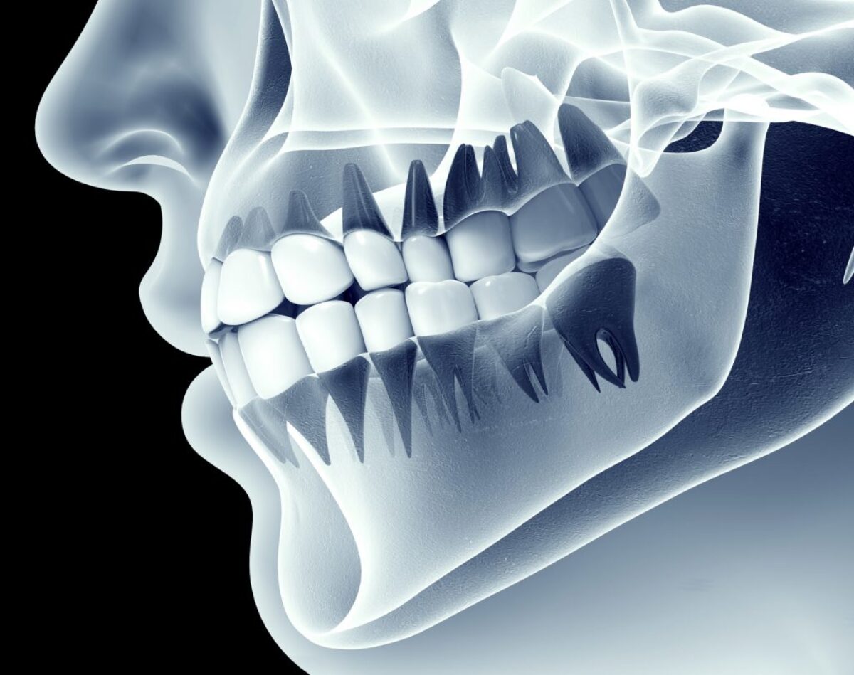 3D Dentistry- The New Standard of Dental Care - Greyfinch, image size:1200x949