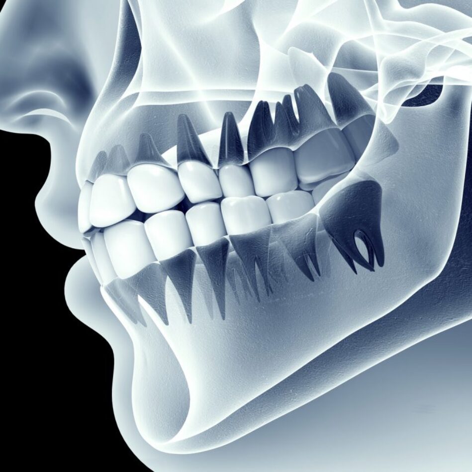 3D Dentistry- The New Standard of Dental Care - Greyfinch