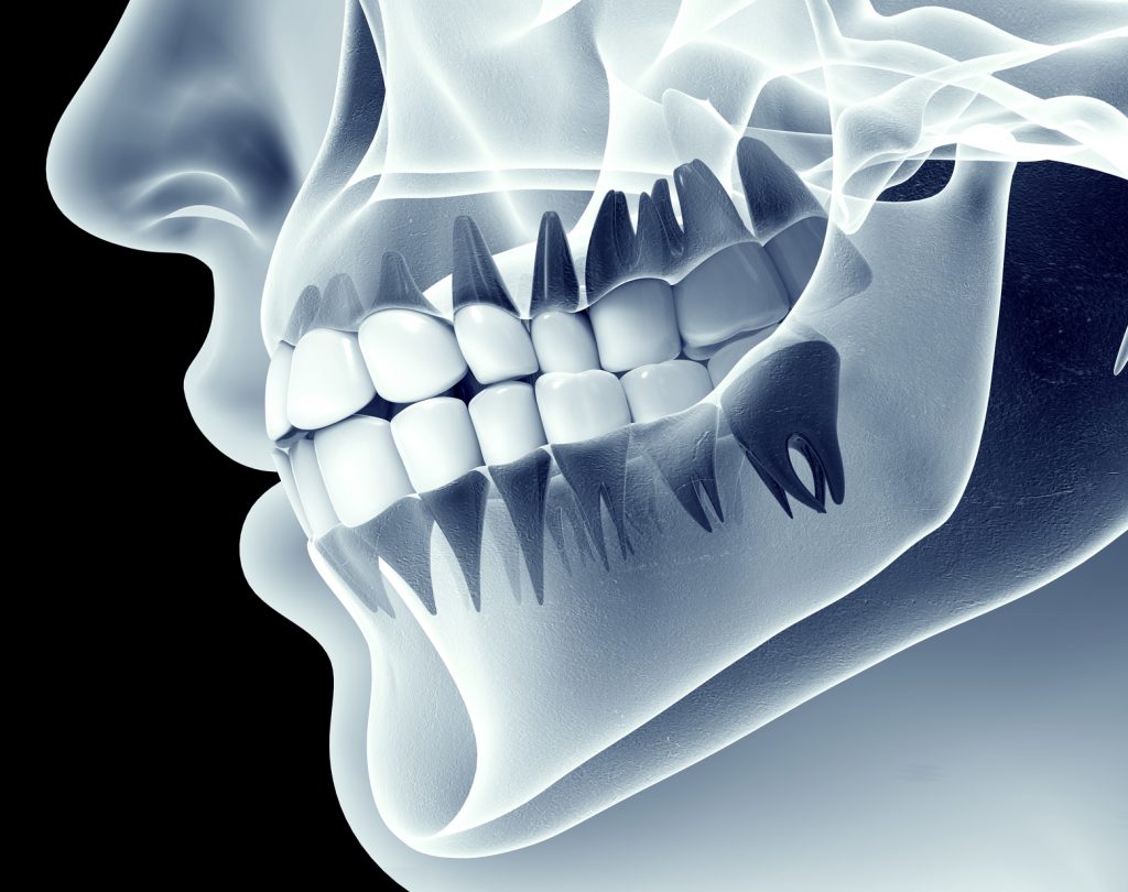 3D Dentistry