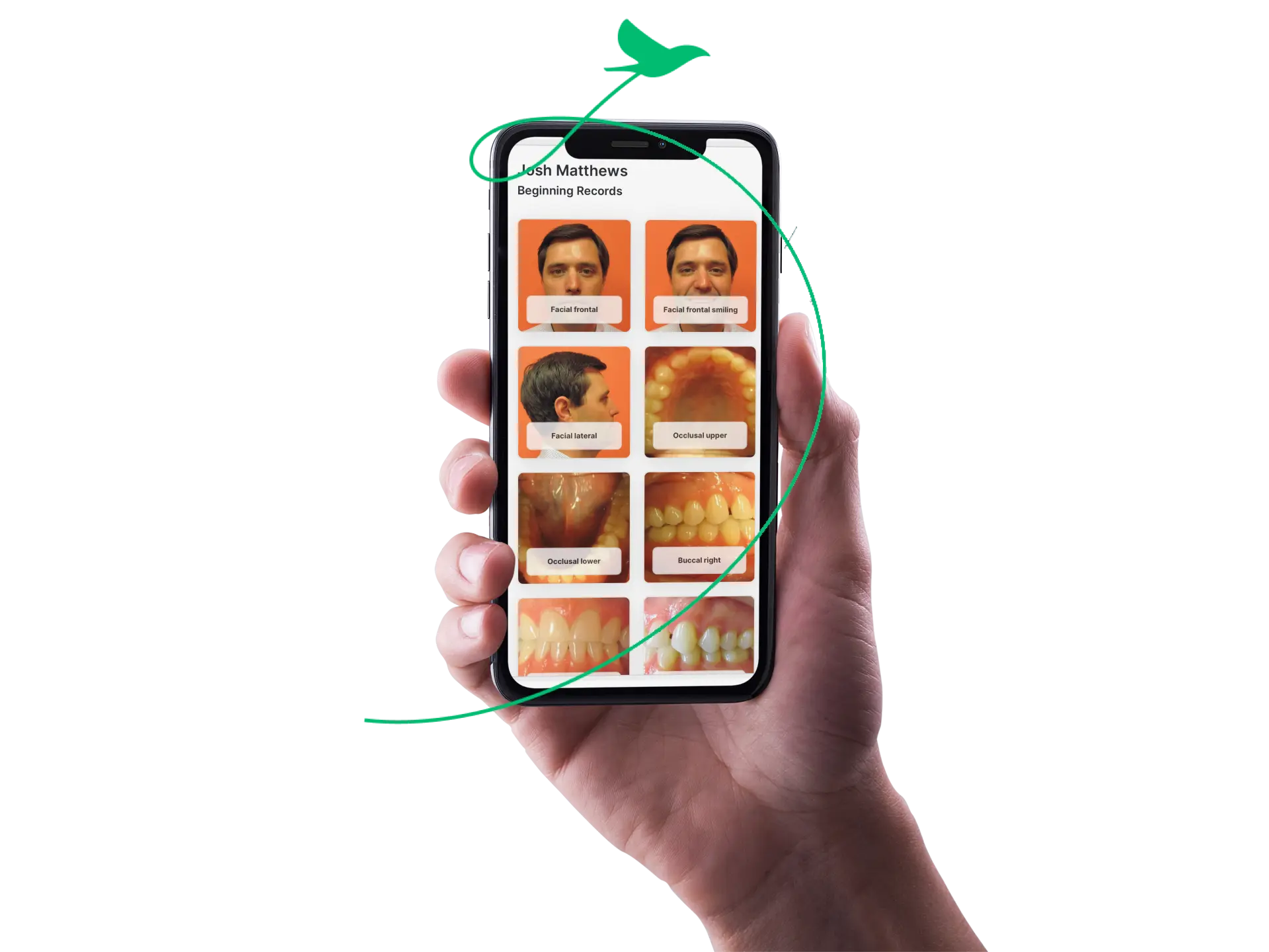 Capture records photos faster
